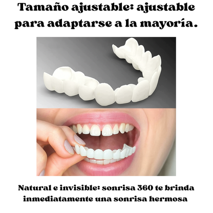 Carillas Dentales Instantáneas Sonrisa 360™ Sin dentista.