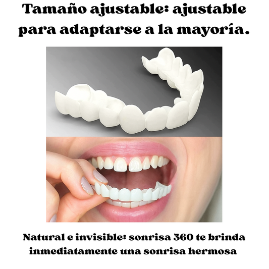 Carillas Dentales Instantáneas Sonrisa 360™ Sin dentista.