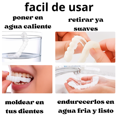 Carillas Dentales Instantáneas Sonrisa 360™ Sin dentista.
