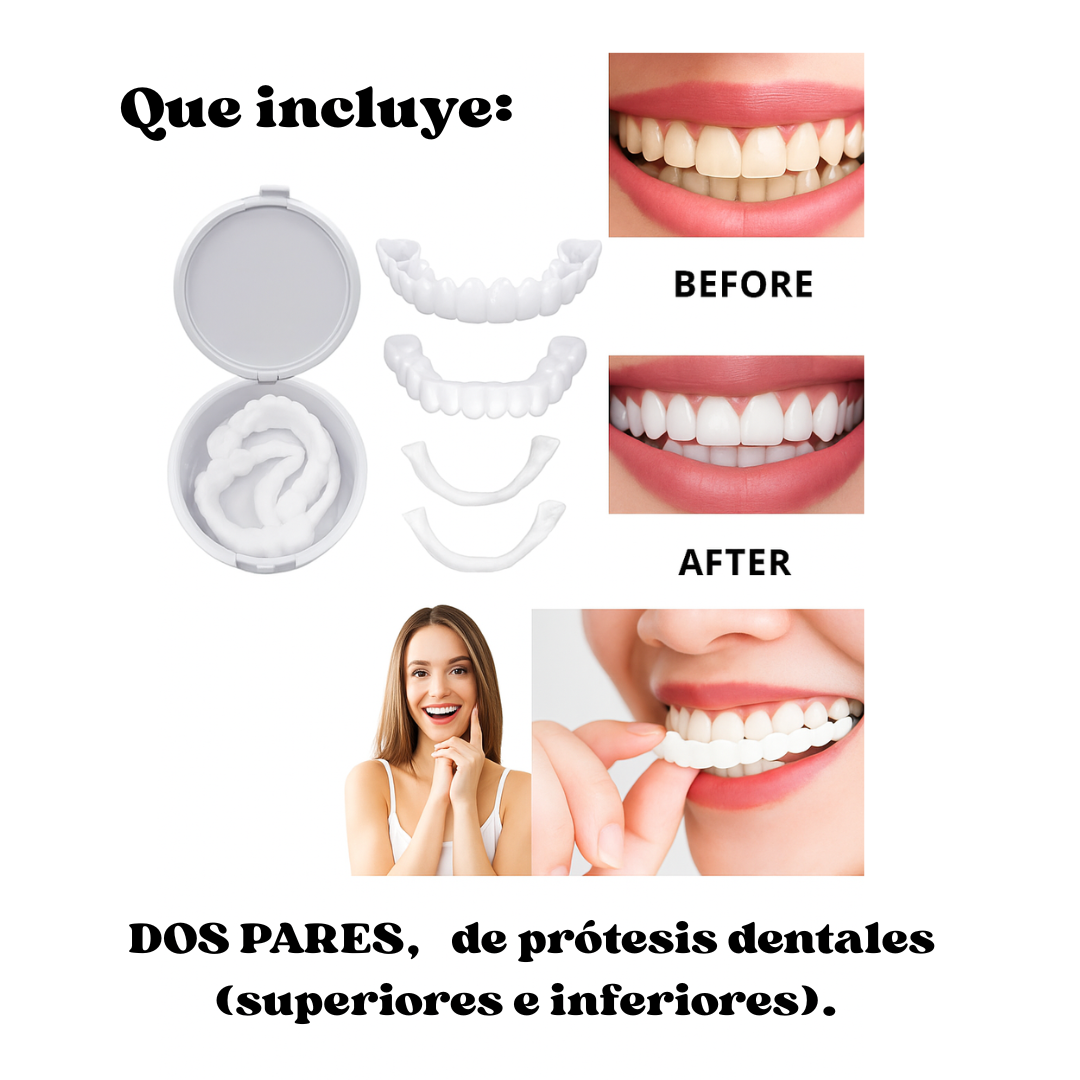 Carillas Dentales Instantáneas Sonrisa 360™ Sin dentista.