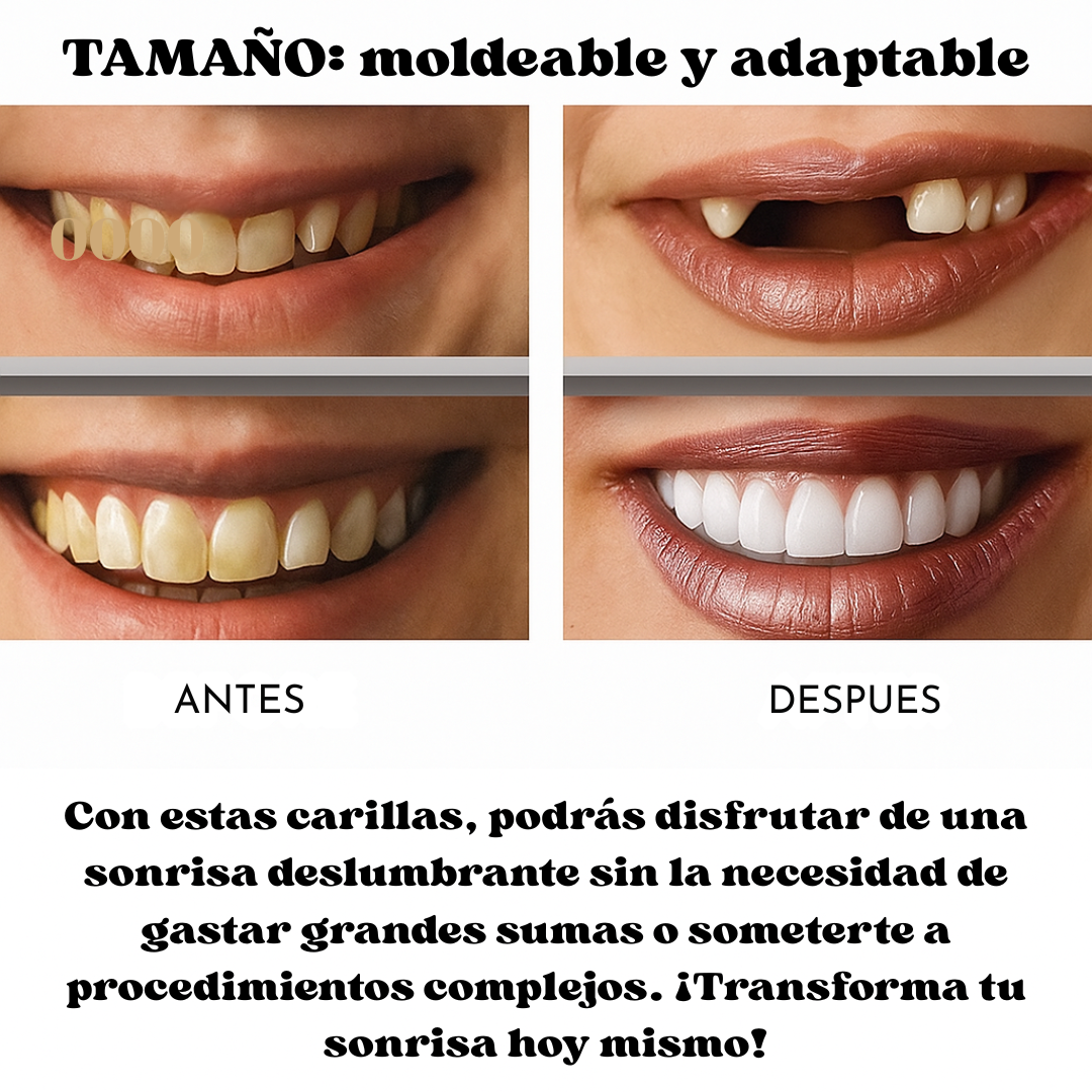 Carillas Dentales Instantáneas Sonrisa 360™ Sin dentista.