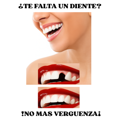 Carillas Dentales Instantáneas Sonrisa 360™ Sin dentista.
